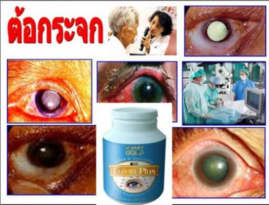 ลูทีน พลัส(Lutein Plus) Minery Gold