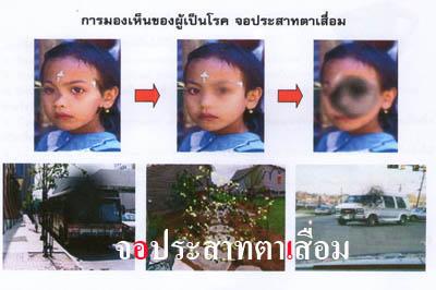 ลูทีน พลัส(Lutein Plus) Minery Gold