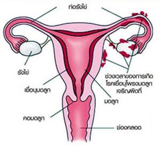 AVATA สูตร 2(อาวาตา) คืนความสาวให้คุณผู้หญิง ได้จริง