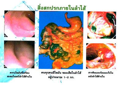 D-Tox for night(ดีท็อก ฟอร์ ไนท์) ผลิตภัณฑ์คลอโรฟิลล์เพื่อสุขภาพ