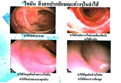 D-Tox for night(ดีท็อก ฟอร์ ไนท์) ผลิตภัณฑ์คลอโรฟิลล์เพื่อสุขภาพ
